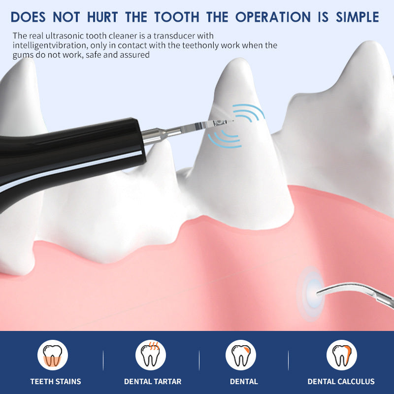 Ultrasonic Pet Teeth Cleaner – Safe & Painless Dental Care for Dogs & Cats